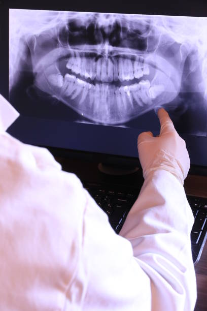 Best Emergency Broken Tooth Repair in Newfoundland, NJ