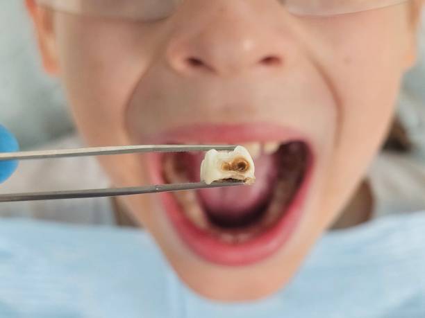Best Emergency Dental Care for Trauma or Injury in Newfoundland, NJ